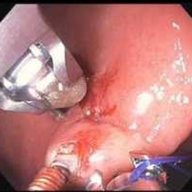 43b754_1c17d45b32714a0c9b19c77c9a80b5ee_mv2