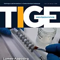 TIGE_edited